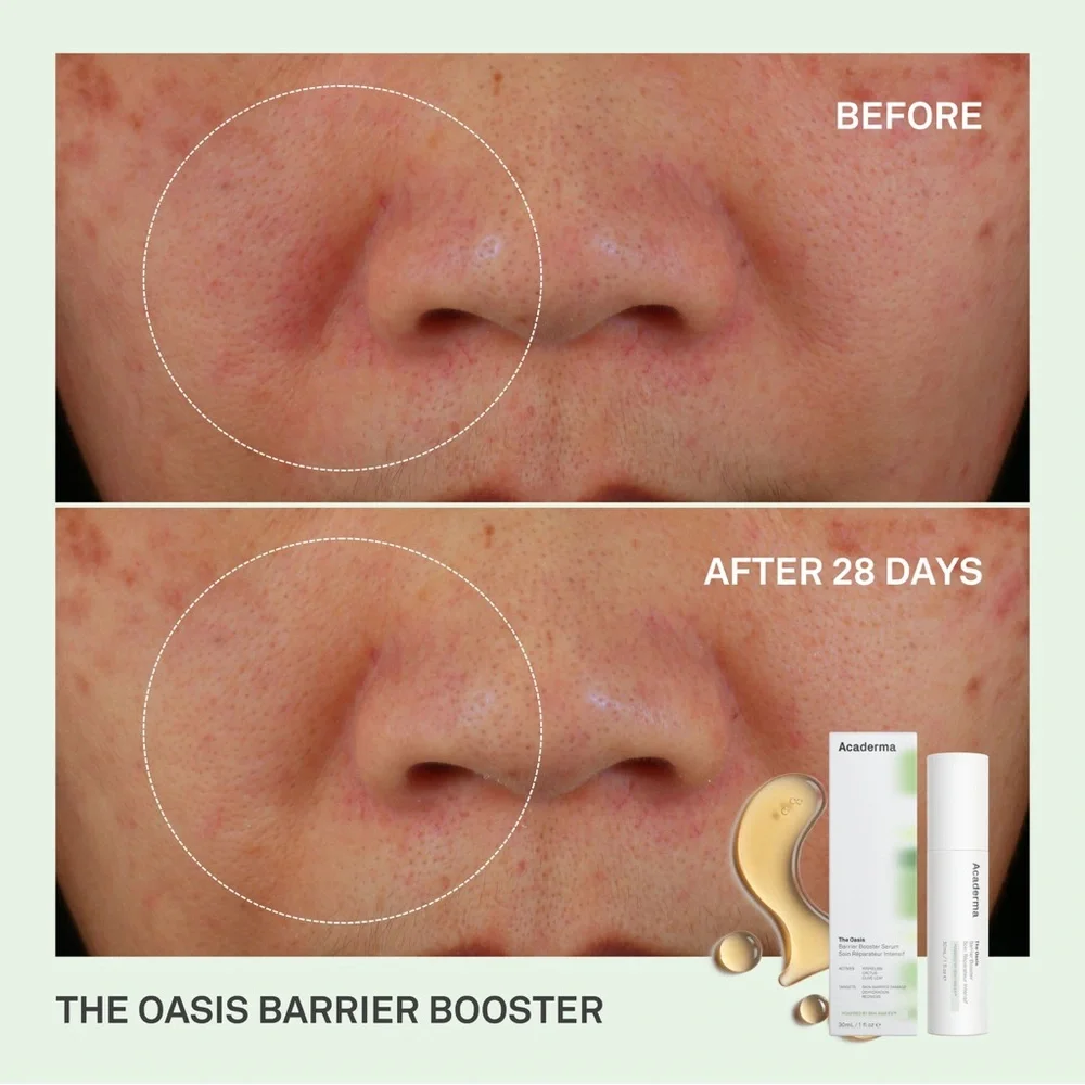 3/$15 Acaderma The Oasis Barrier Booster Serum Mini Size
